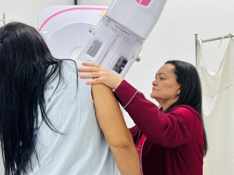 Saiba como fazer mamografia no Hospital da Mulher de Alagoas