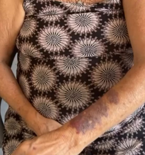 Influenciador Rico Melquiades denuncia tentativa de feminicídio contra a tia e agressão à avó