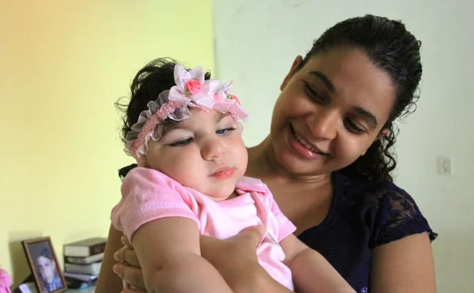 Crianças com microcefalia terão atendimento garantido