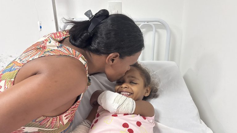 Criança se recupera no HGE após sofrer queimaduras durante acidente com café